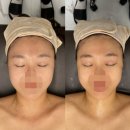 평택여자중학교 | 평택 이중턱 관리 유하이뷰티앤바디 에너지테라피 예비신부 후기