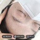초이#