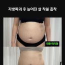 서연뷰티 | 부산 서연뷰티 시청점 복부 리핏온다 리프팅 관리 후기❤️