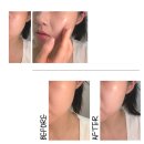 한빛나노멀티케어 | 30대 기미잡티 관리 홈케어 솜솜벨 NMN 나노앰플 다크스팟 멀티패치