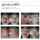 케이피부과의원 이미지