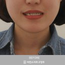 아인스덴탈 이미지