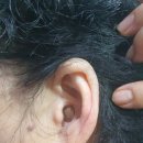 시그니아독일보청기대구북구센터 이미지