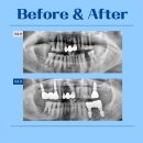 이플랜트치과의원 이미지