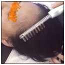 동화새터길 | 봉담피부관리 찾는다면? DERMA10 디바이스 케어 가능한 봉담 에스테틱 어썸 후기