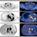 PET CT 검사 방법 준비 비용 (펫시티) 이미지