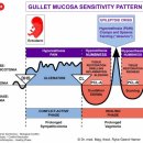 췌장관 pancreas ducts 이미지