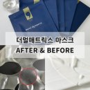 [더멀매트릭스 마스크팩] 찐후기 / 하얀겔이 라이스 페이퍼로! (피지흡착 &amp; 콜라겐흡수) 신세계잖아?!