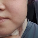 서구-01-55 | 악명 높은 공포의 사랑니 발치 후기&amp; 다사다난 했고 힘들었던 일들(사랑니 발치 당일 ~ 4일차) #01