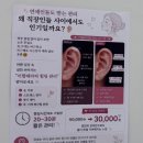 첨단과기로208번길2R | 첨단 아이라이트 광주 첨단 쌍암동 이혈테라피 찐만족 후기