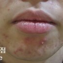 리유한의원 네이버블로그