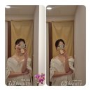 라인 | 압구정 체형관리 위뷰티 승모근관리 여리여리한 어깨라인 후기