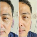 더 다이어트0313 기초화장품 사용후기