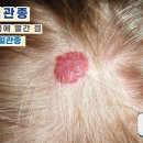 포두반점 이미지