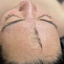 러블리스킨&바디 | [대전/서구] 스킨플래닝받고 붓기까지 싹 빼고싶다면 “에르벨에스테틱 대전괴정점”