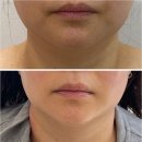 마르멜로디자인 | 내 얼굴에 꼭 맞는 자연미, 진짜 나만을 위한 용암동속눈썹 과연 어디서 받아야 할까
