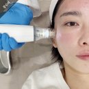 좋아요한의원 | 해운대 센텀시티역 피부과 한의원 포텐자 효과 내돈내산 후기