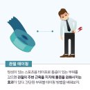 관절을 위한 '테이핑 요법' 이미지