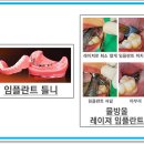 문치과의원 이미지