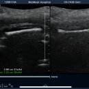 강서구-21 | 임신 21주 정밀초음파 후기와 태동 변화 in 강서미즈메디