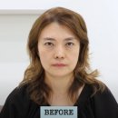 리즈성형외과의원 | 50대에도 자신감 가득 엄마의 두번째 리즈시절, 중년 눈성형·하안검·이마거상 리얼 후기