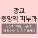 톤즈의원 수원광교점 | 광교중앙역피부과 써마지 관리, 시술 전 꼭 알아야 할 기준 5가지