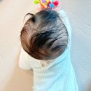 하니 | 아기 단두 두상교정 3주차 하니헬멧 후기 추천인 자리 있음