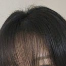 현암로89번길 | 점점 풍성해지는 두피 <용인 분당 | 닷포유 SMP> 두피 채우기 2회차 경과, 3회차 후기