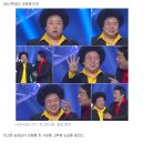 송영길, 눈·코 '400만원'성형 고백…유민상 "이걸 돈내고?" 이미지