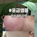 주식회사 에끌라두 티스토리