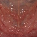 선 치과기공소 이미지