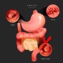 엉덩이 무거우면 직장암(直腸癌) 위험 높다… 이미지