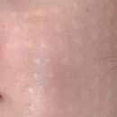 나세르의원 | 나세르 의원 | 리주란 수면마취 내돈내산 후기 | 강남 수면마취 나세르 의원