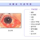 요즘 용어--신문 기사-- 알고나 지냅시다--27-- 유행성 각결막염, 환자의세면도구, 수영장, 목욕탕 같이 쓰지말것 이미지