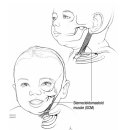 SRC재활병원2 | 자세성 사경 의심, 부산성모병원 재활의학과 진료 후기 - 2