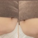 피부;피어나리