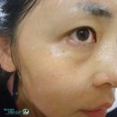 스크럽 추천 스위스라인 저자극 진주스크럽 포스비탈 엑스폴리에이팅 리화이너 스크럽제 추천