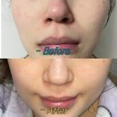 [공지] 레싫모 모여라~~~넘버즈인 블루 레티놀 솔직한 5일 후기