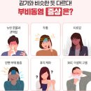 급성,만성 부비동염 증상 이미지