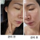 피부미애