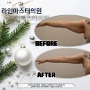 라인마스터의원 네이버블로그