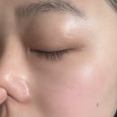 진131-5 | 131앰플 추천｜피지조절과 모공케어에 도움을 준 셀라딕스131앰플 사용후기