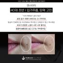 엔에이지