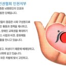 인천뇌병변장애인인권협회 이미지