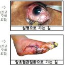 &#39;폐암으로 가는 길&#39; 담뱃갑 새 건강경고 문구·그림 적용 이미지