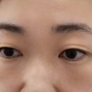 스칼프랩앤뷰티 속눈썹&눈썹&탈모 의정부점 네이버블로그