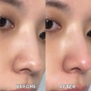 씨제이올리브영(주)플러스점 | 올리브영 피지클리너 추천템, 메디필엑스트라슈퍼9플러스3X피지연화제 솔직후기