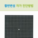 네모안경콘택트 네이버블로그