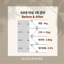춘천 다이어트 모녀동반 50대 7주 8.6kg 감량 부종개선 에소코핏 춘천 퇴계점