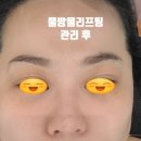 콜마트 | 포항 장성동피부관리 포항피부관리 임산부도 관리가능한 보노에스테틱